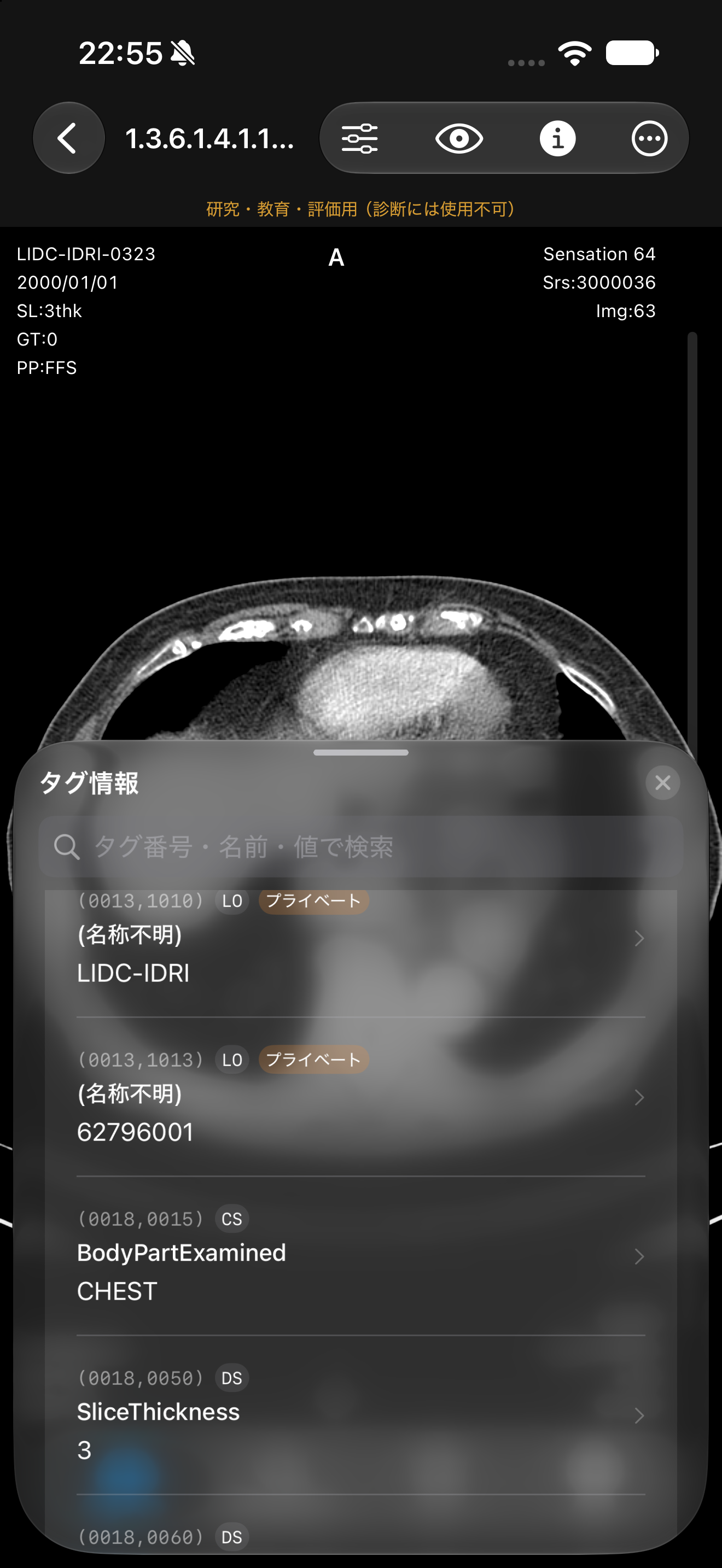 Screenshot of MediScope's DICOM tag list