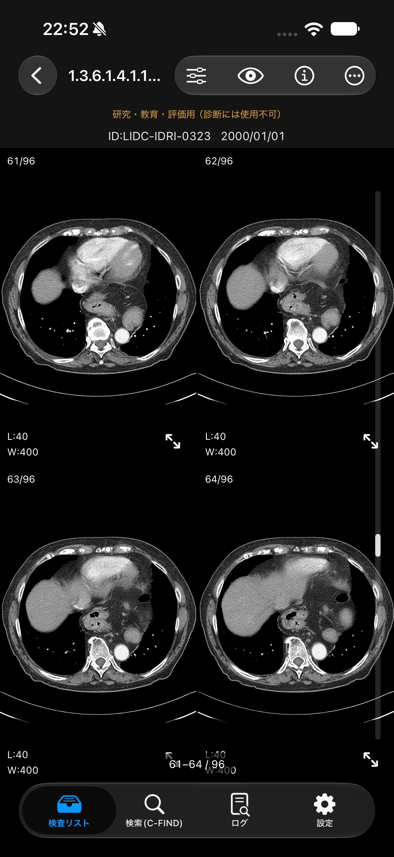 Screenshot of MediScope showing CT images of a series in a 2x2 tile view