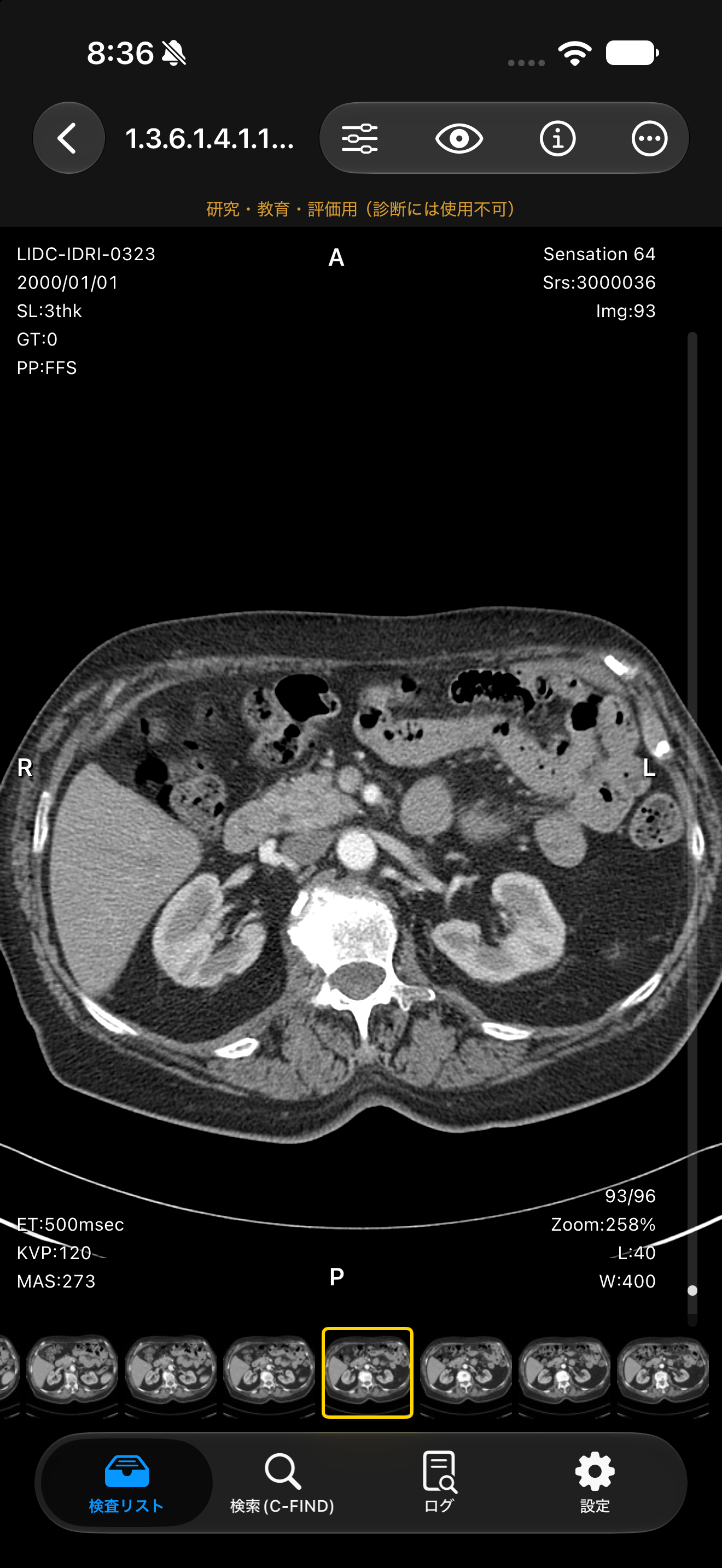 Screenshot of the MediScope DICOM viewer app showing a CT image with corner annotations and a filmstrip