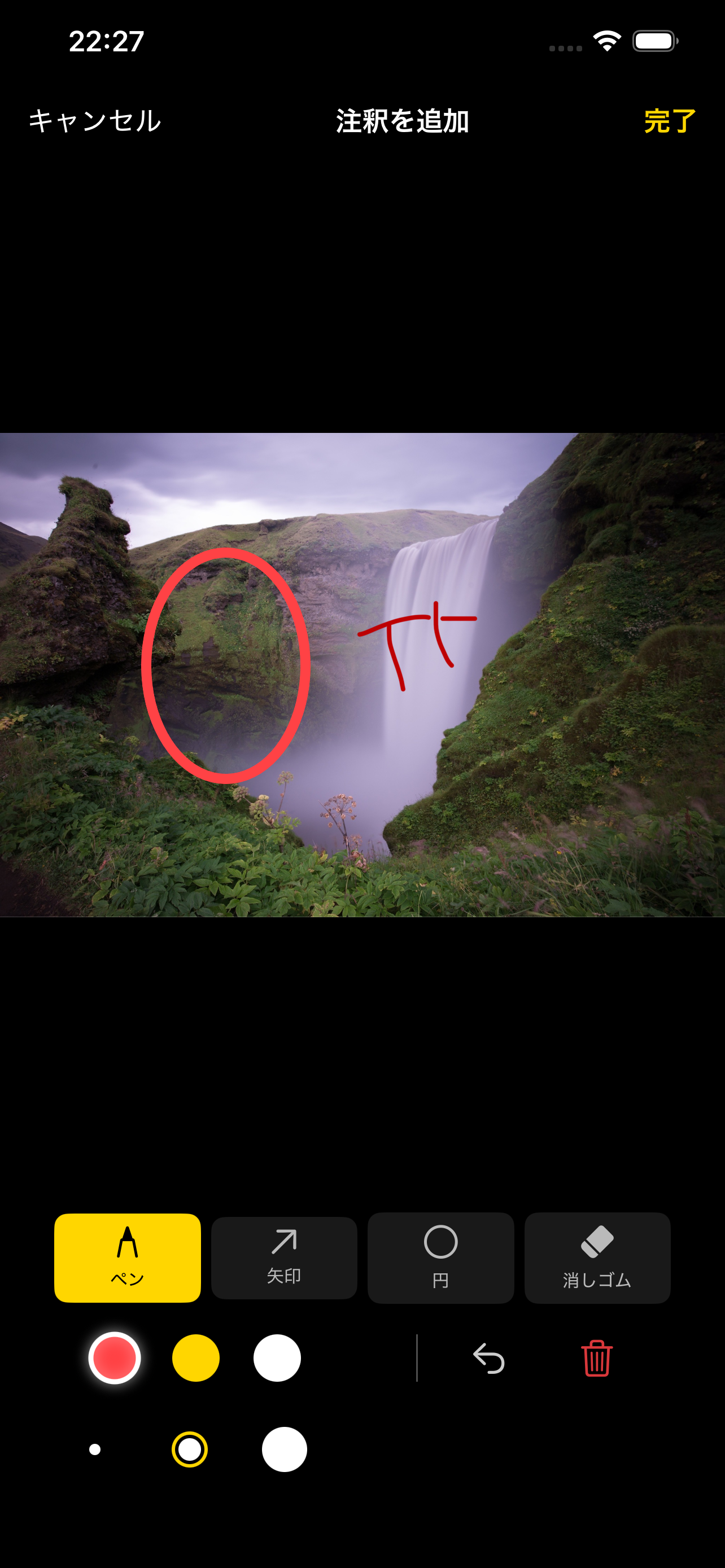 Screenshot of MediShot's image annotation tool with arrow and circle markup