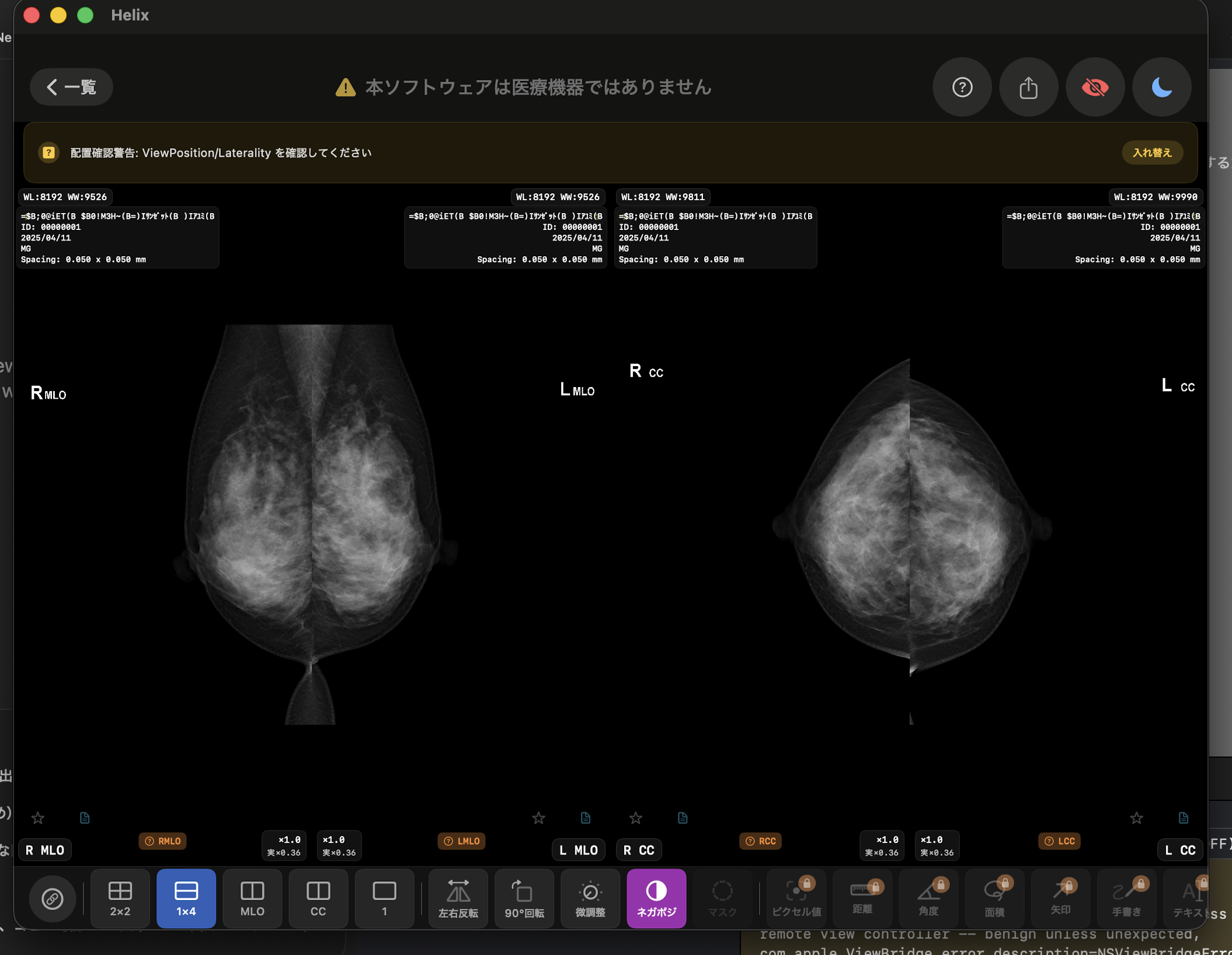 Preview image of a mammography viewer interface with a four-panel layout